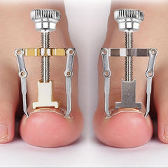 2Pcs Ingrown Toenail Protector Pedicure Tool Stainless Steel Foot Care
