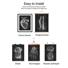 Vintage Human Anatomy Artwork Skeleton Muscle System Poster Canvas Print