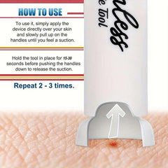 Portable Mosquito Bite Extraction Needle Device