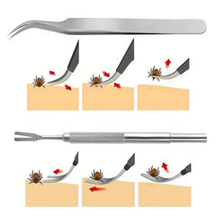 2pcs Tick Flea Remover Tool for Cats and Dogs Safe Tick Flea Removal