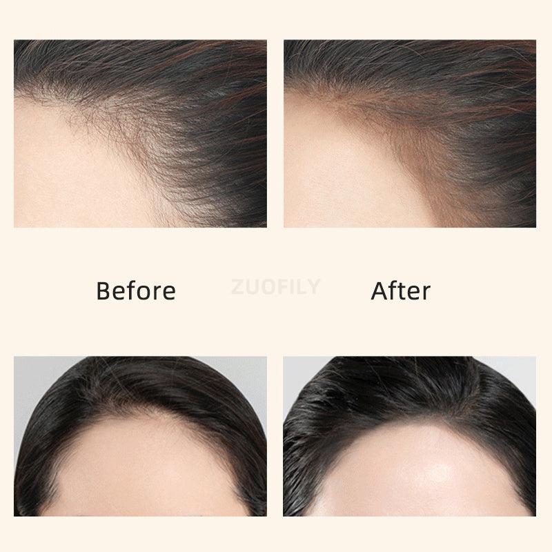 Hairline Shadow Stick Hair Shading Sponge Pen Waterproof Hair Root Concealer