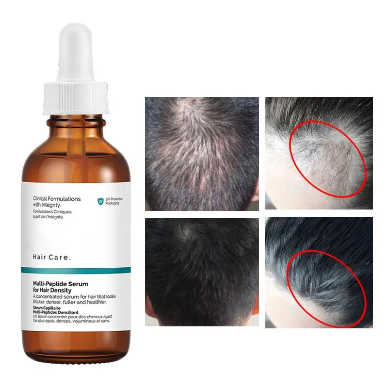 img_319835