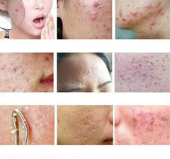 img_635935
