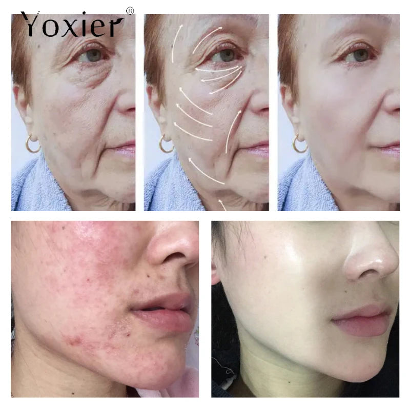 img_315436