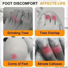 Soft Silicone Toe Protectors - 10/20pcs Breathable Anti-wear Protection