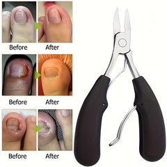 2Pcs Toe Nail Clippers For Ingrown Nails Thick Nails Cutters Dead Skin Dirt Remo
