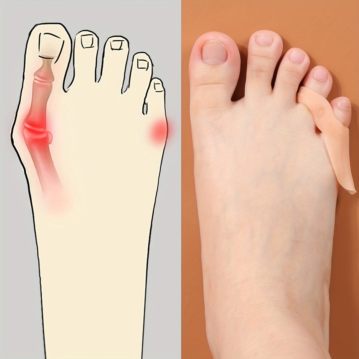 Toe Varus Correction Silicone Sleeve, 1 Pair