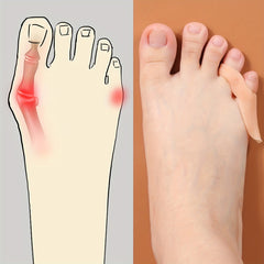 Toe Varus Correction Silicone Sleeve, 1 Pair