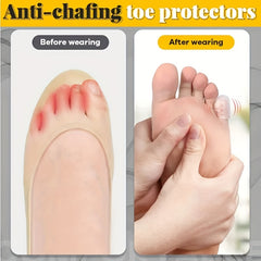 10pcs Unisex Silicone Toe Protective Cover Separation Waterproof
