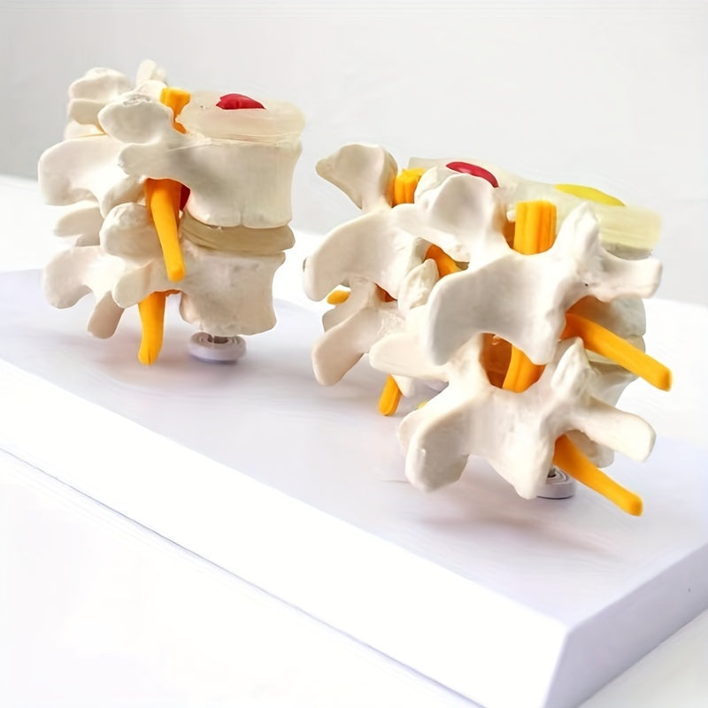 Lumbar Vertebrae Lesion Model Teaching Tool