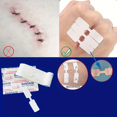 5pcs Quick Stitching Protective Adhesive Bandages