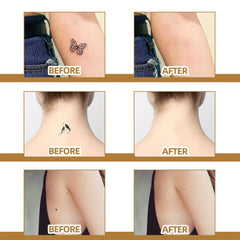 60pcs Invisible Concealer Stickers For Scars Acne Marks Waterproof Skin Tone