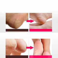 Ultra-thin Silicone Heel Protector Prevents Foot Cracks