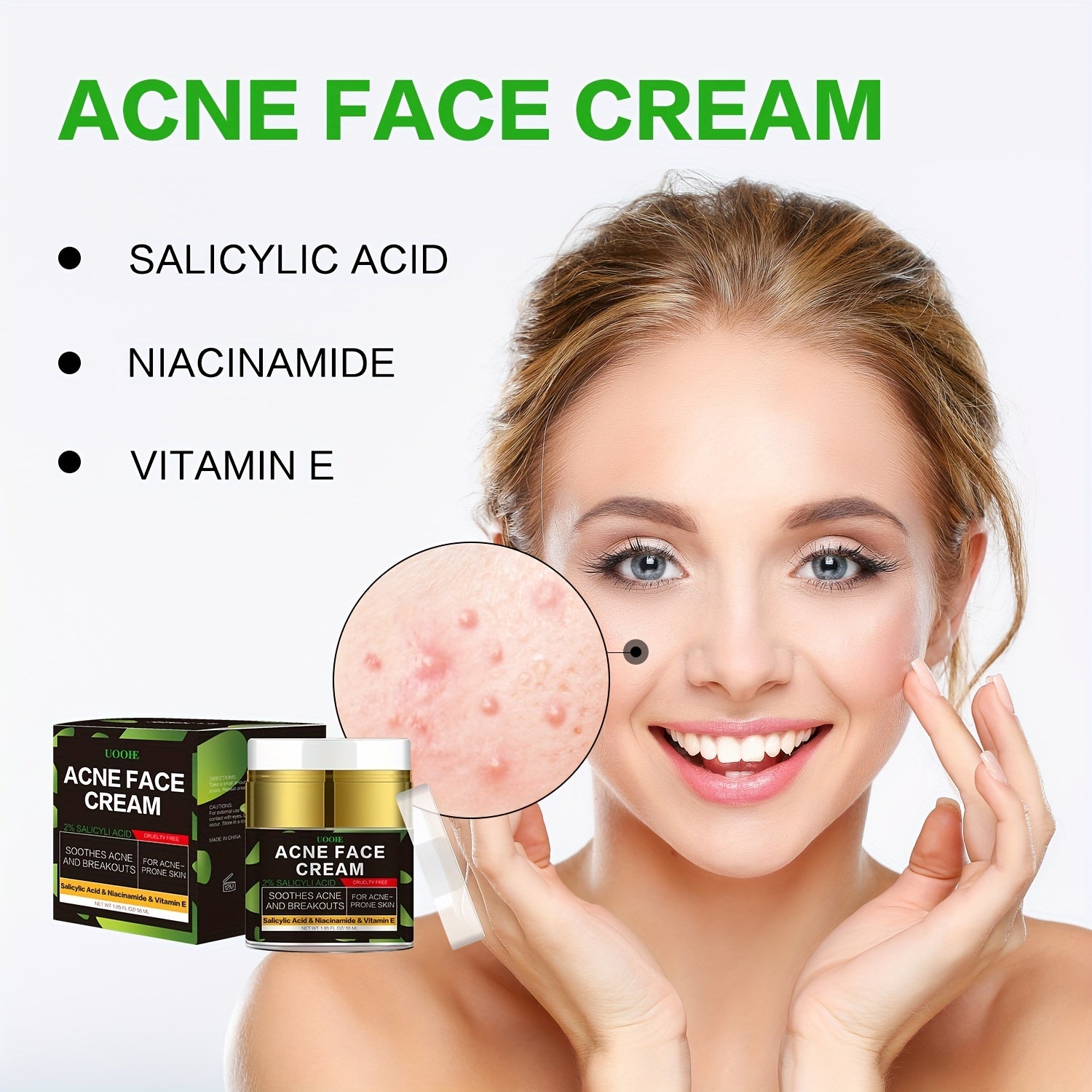 Acne Cream with Niacinamide & Salicylic Acid