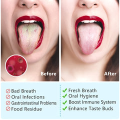 Portable Stainless Steel Tongue Scraper Set