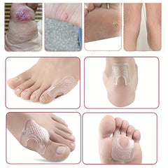 10pcs Waterproof Gel Callus Pads - Reusable Toe Cushions for Rubbing
