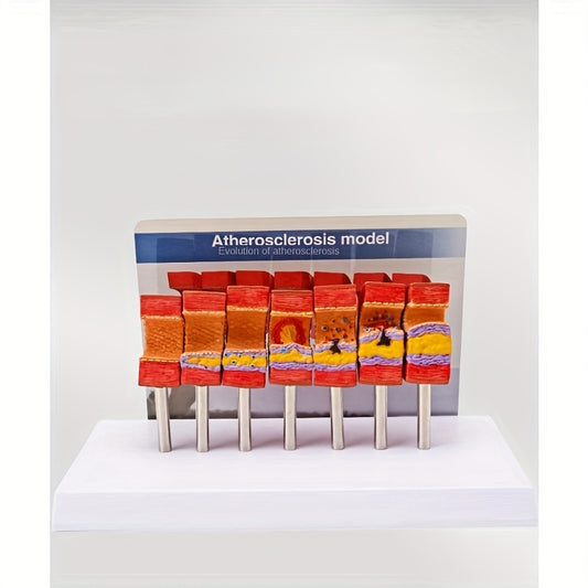 Educational Arterial Sclerosis Model for Students
