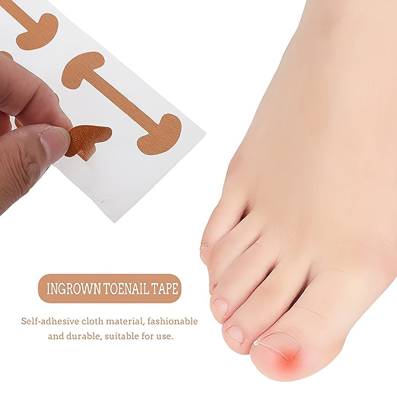Nail Correction Stickers Toe Nail Correction Devices