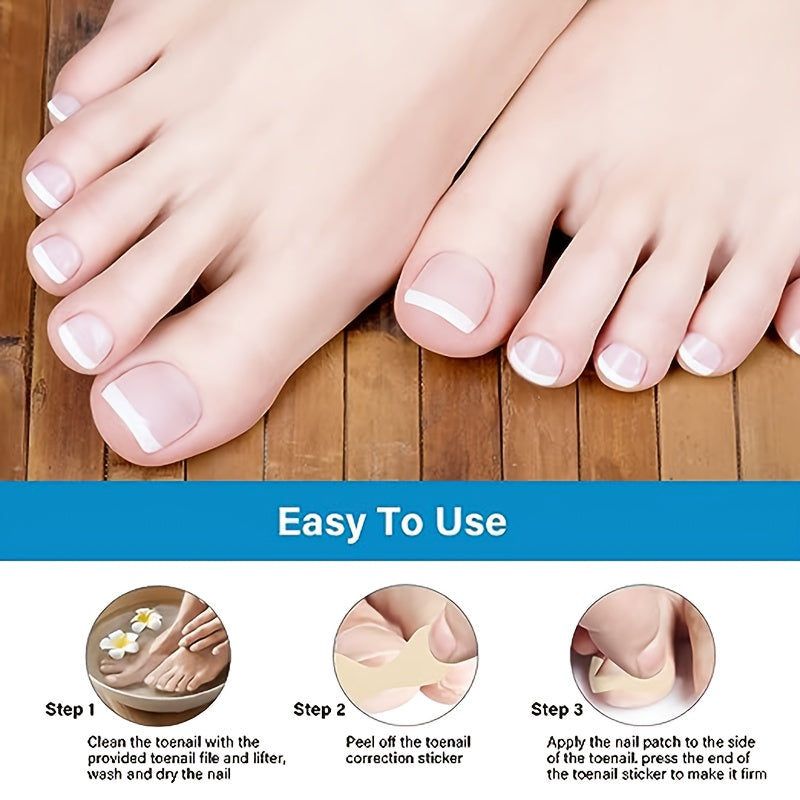 50pcs Glue Nail Correction Device Toe Nail Deformation Patch