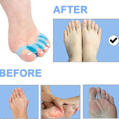 4 Silicone Toe Spacers Bunion Hammertoe Straightener