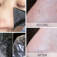 Nose Cleansing Pores Mask Pore Cleaner Acne Mask Deep Nose Pore Cleaning
