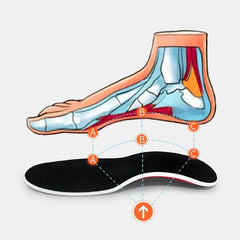 Plantar Fasciitis Arch Support Insoles for Pain Relief