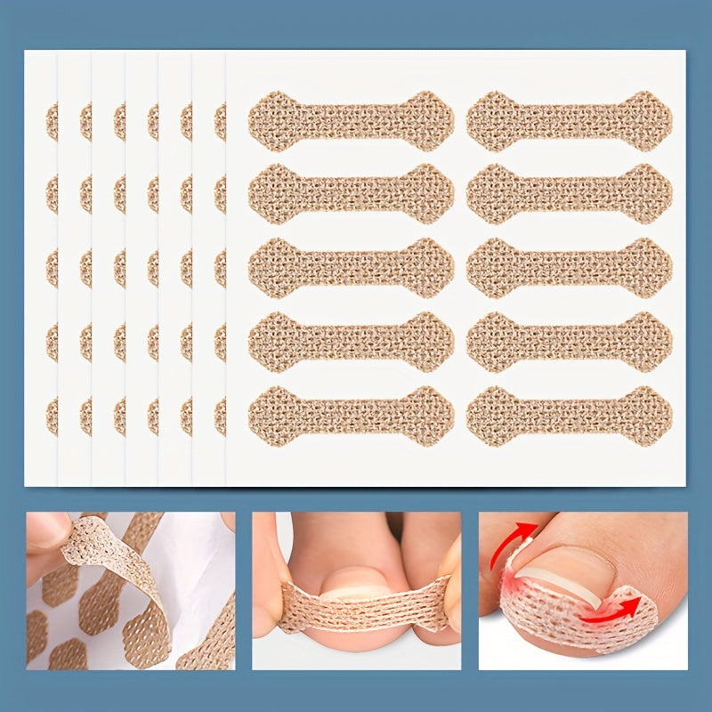 20pcs Toe Patch Set for Ingrown Toenail Relief & Nail Care Support