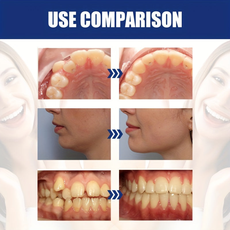 Orthodontic Mouth Guard Anti Grub Bracket Device Protection