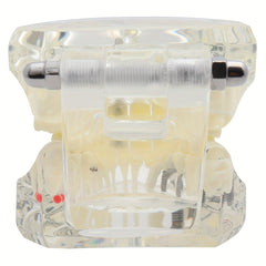 Dental Restoration Model Pathological Tooth Model Implant Tooth Model