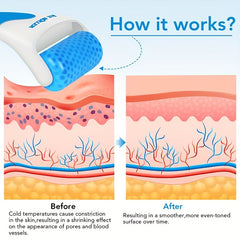 Ice Roller For Face & Eye Puffiness Relieve