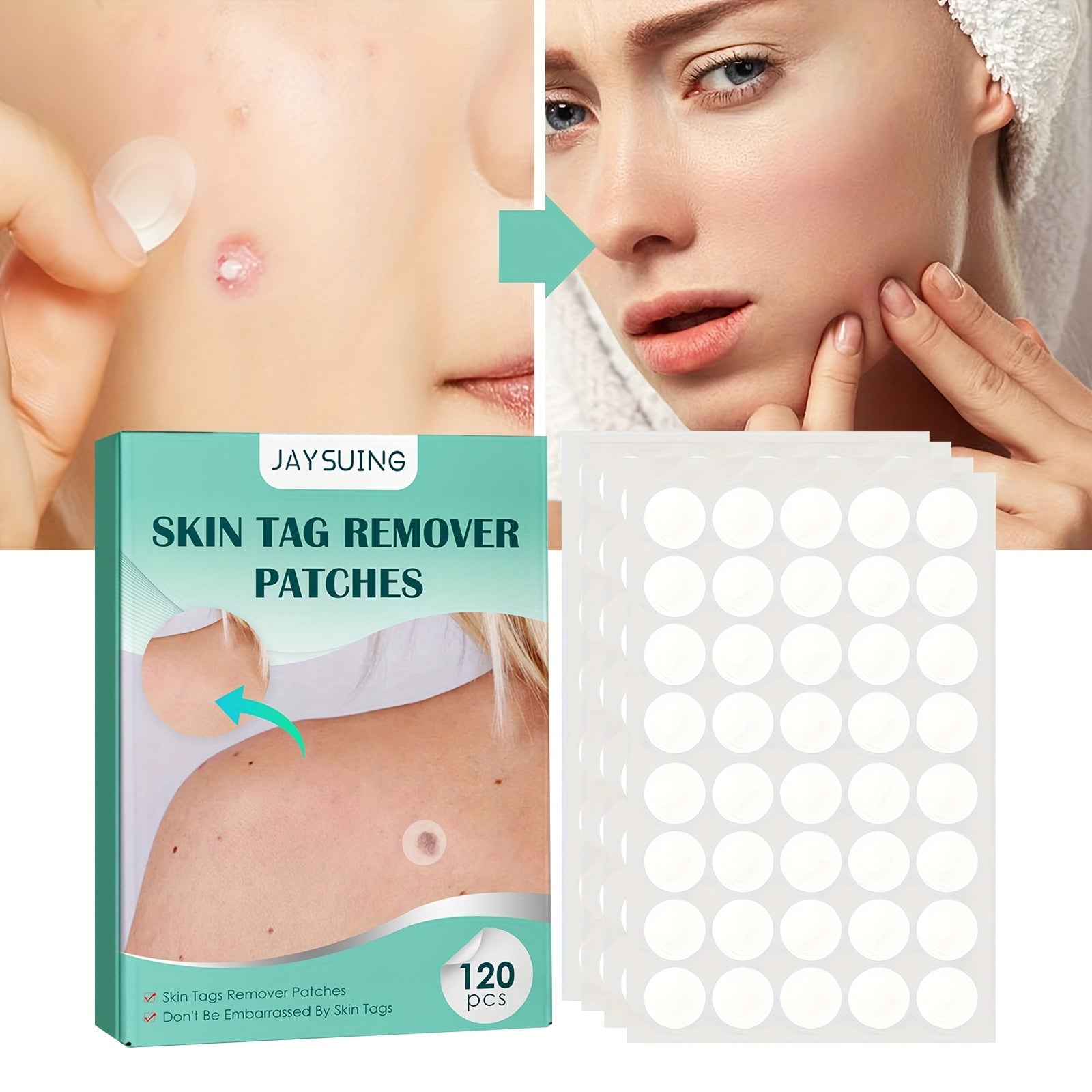 Acne Patches Hydrocolloid Acne Pimple Patch 120pcs