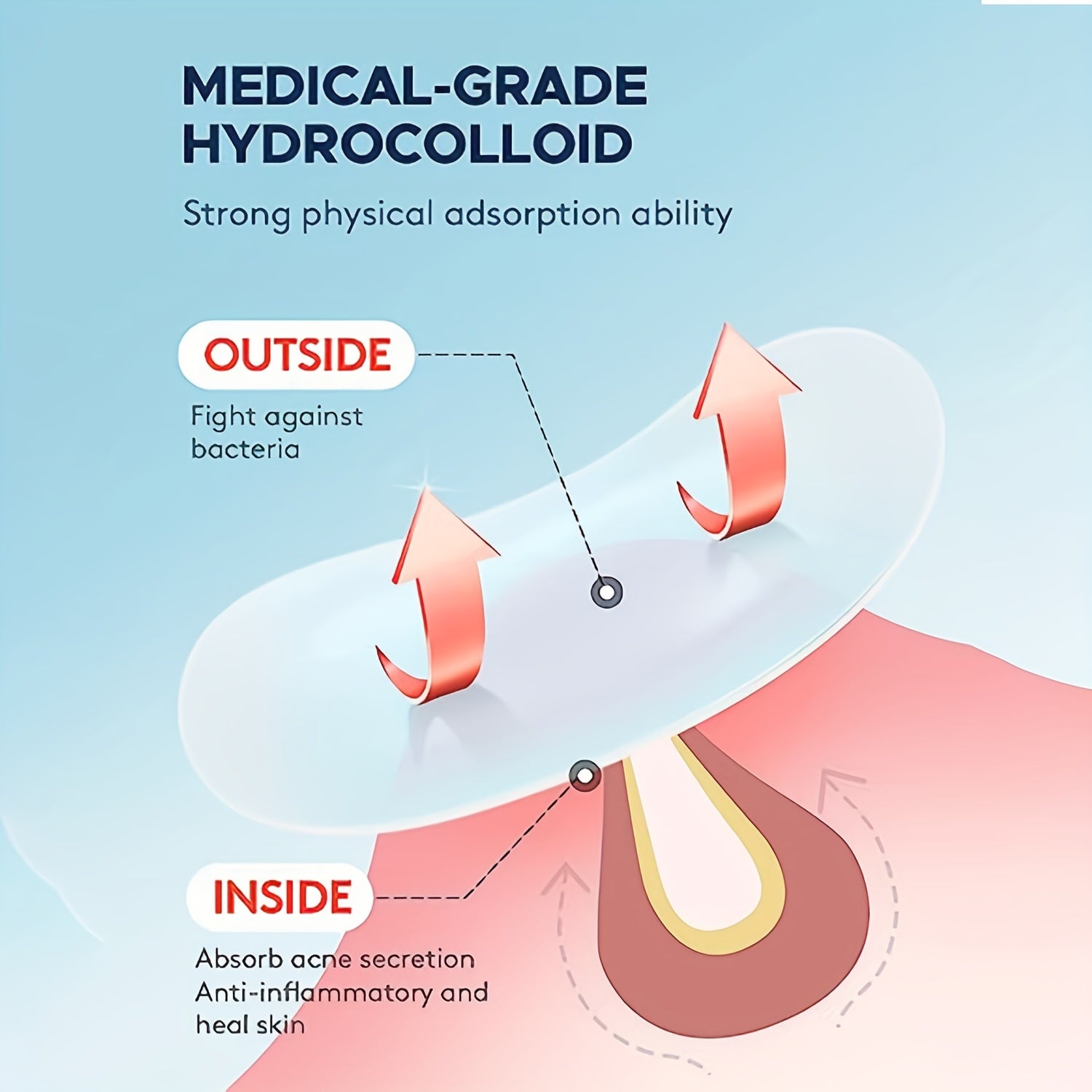 Hydrocolloid Acne Patches - Cover Zits and Blemishes