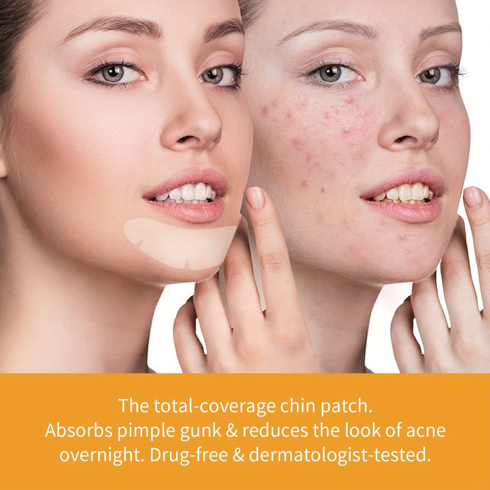 Hydrocolloid Acne Pimple Patch - Acne Cleansing Patch