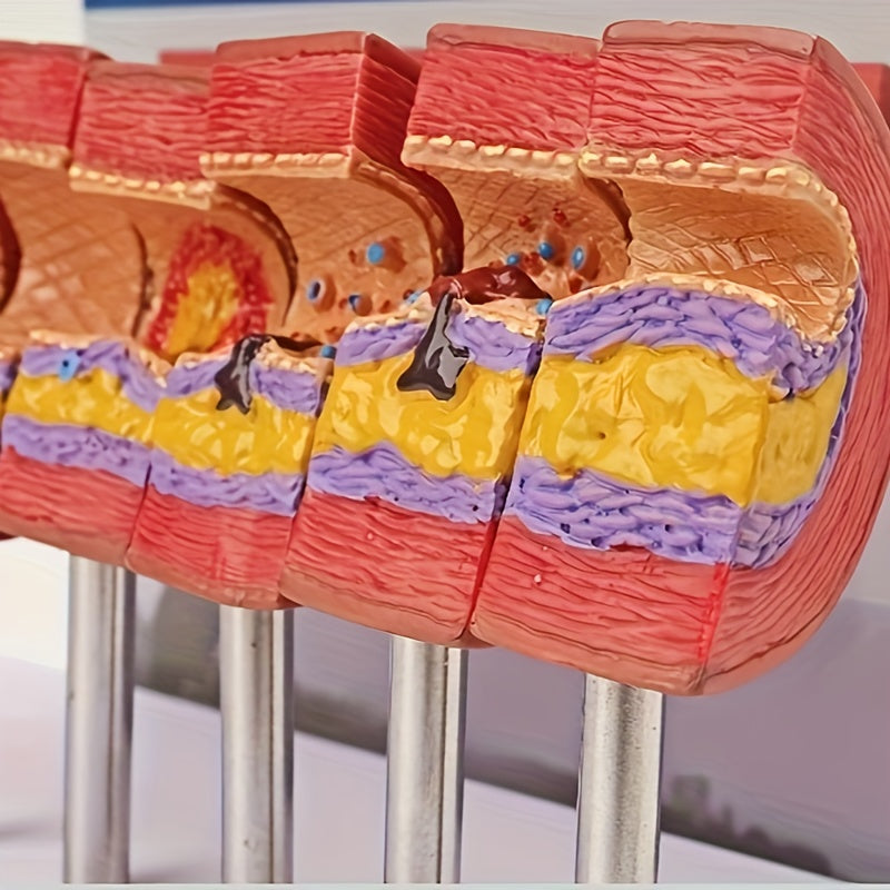 Educational Arterial Sclerosis Model for Students