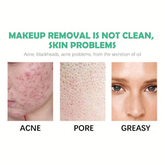 Hydrating Makeup Remover for Sensitive Skin - Aloe & Purslane Extract