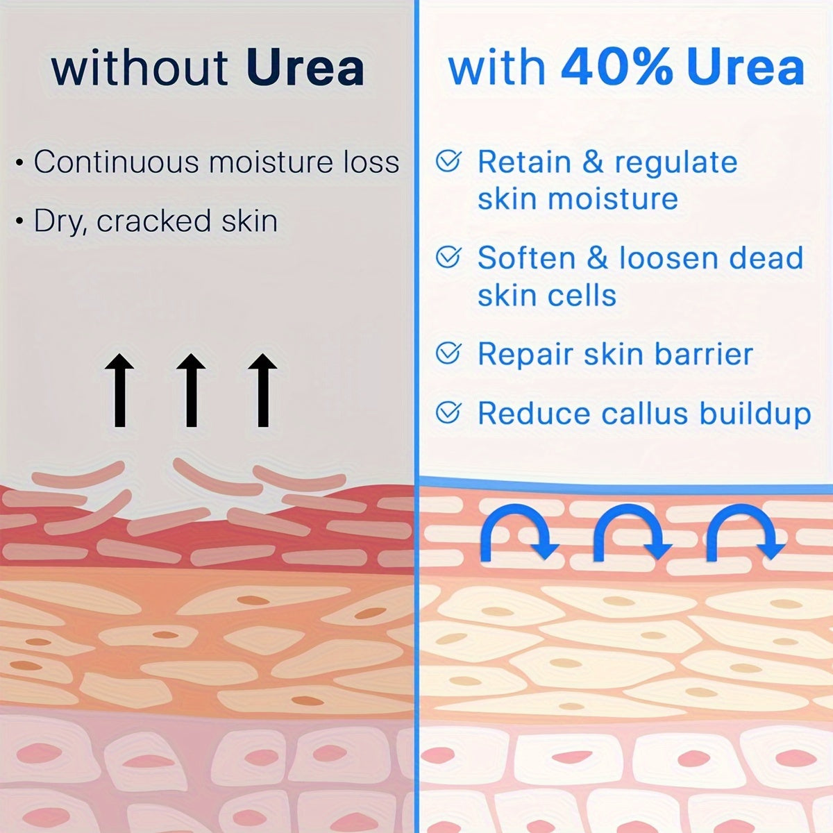 Urea Cream 40 Plus Salicylic Acid 2 Foot Cream