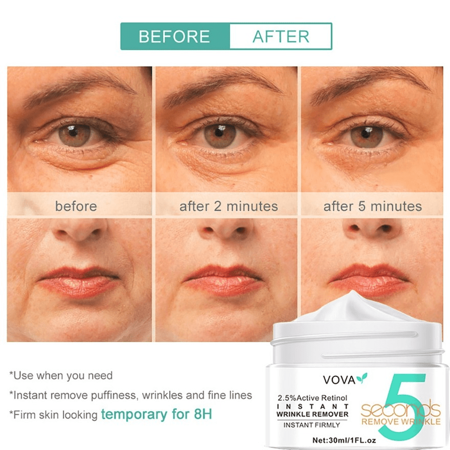 Wrinkle Remover Cream for Smooth Skin