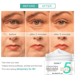 Wrinkle Remover Cream for Smooth Skin