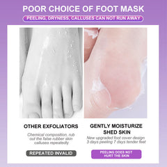 Lavender Foot Peel Mask Exfoliating Foot Care 5 Pairs