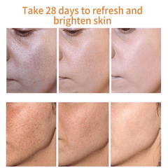 Moisturizing Freckle Cream for Smooth Skin