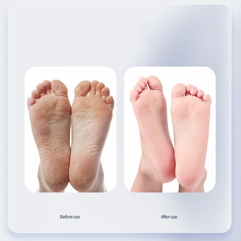 Shal Foot Callus Remover with Moisturizing Cream