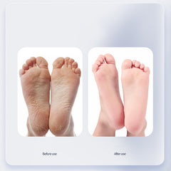 Shal Foot Callus Remover with Moisturizing Cream