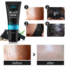 Blackhead Removal Set: Mask, Needle & Silicone Brush - Deep Cleansing Pores