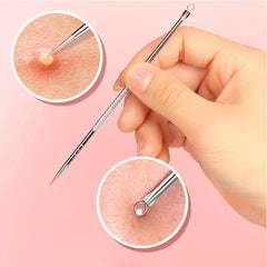 Blackhead Removal Tool Stainless Steel for Face and Nose