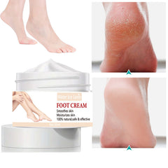 Moisturizing Foot Cream for Heel Repair, Prevents Cracked Skin
