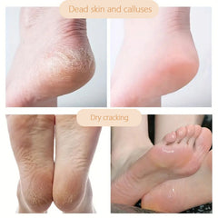 30g Hand & Foot Cream - Moisturizing Crack Repair Cream