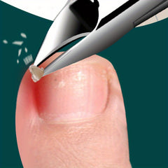 Ingrown Nail Cutting Artifact Nail Pliers Pedicure Tool