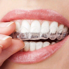 Teeth Whitening Strips for Brighter Smile