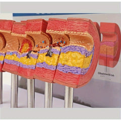 Educational Arterial Sclerosis Model for Students