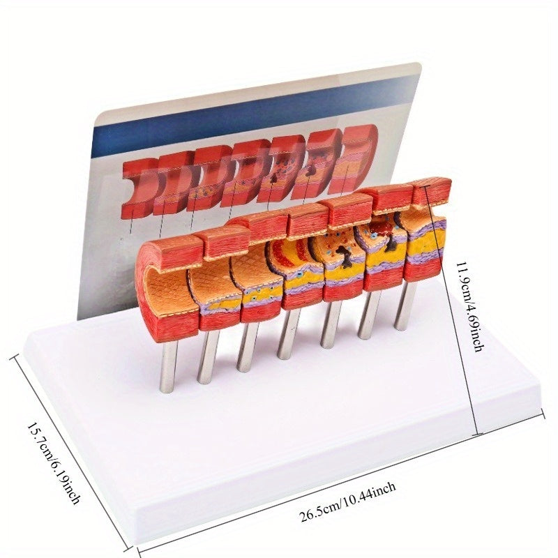 Educational Arterial Sclerosis Model for Students